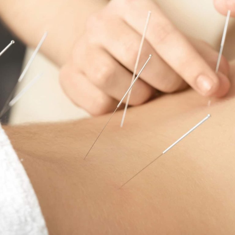 acupuncture in hartland, acupuncture for anxiety in hartland, natural pain management in hartland