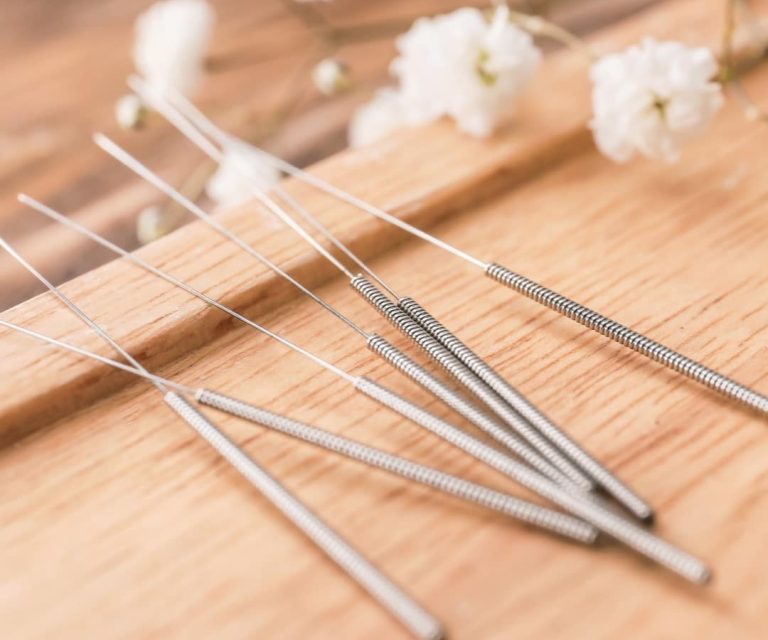 acupuncture in hartland, hartland acupuncture, acupuncture for anxiety in hartland