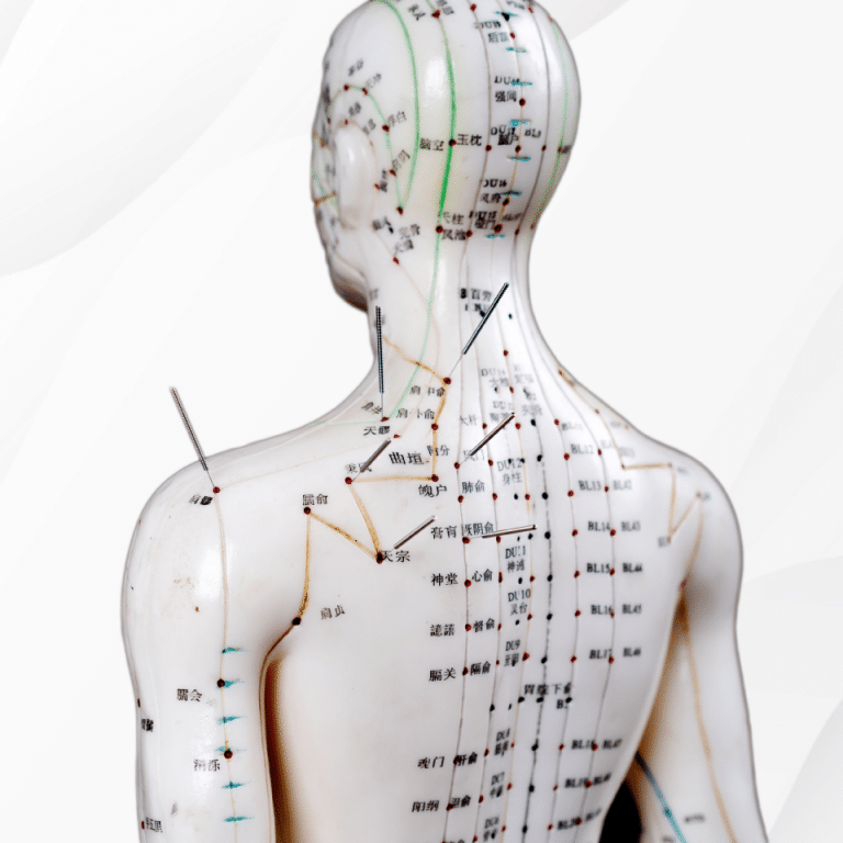 Acupuncturist in Hartland, acupuncture in Hartland, Hartland acupuncture
