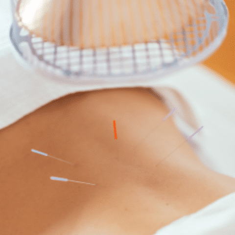 Acupuncturist in Hartland, acupuncture in Hartland, Hartland acupuncture