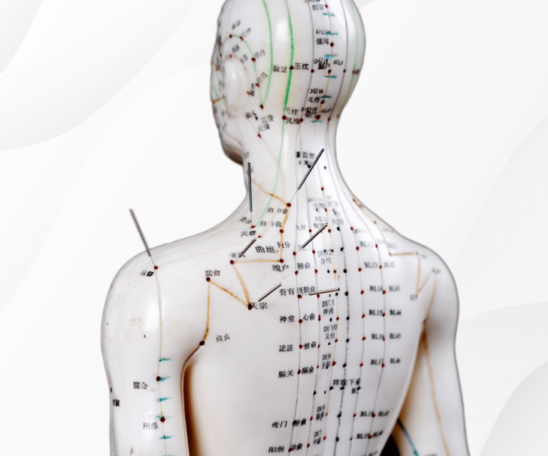 acupuncturist in oconomowoc, acupuncture treatment in oconomowoc, acupuncture services in oconomowoc