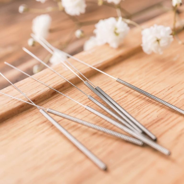 acupuncturist in oconomowoc, oconomowoc acupuncturist, acupuncture in oconomowoc